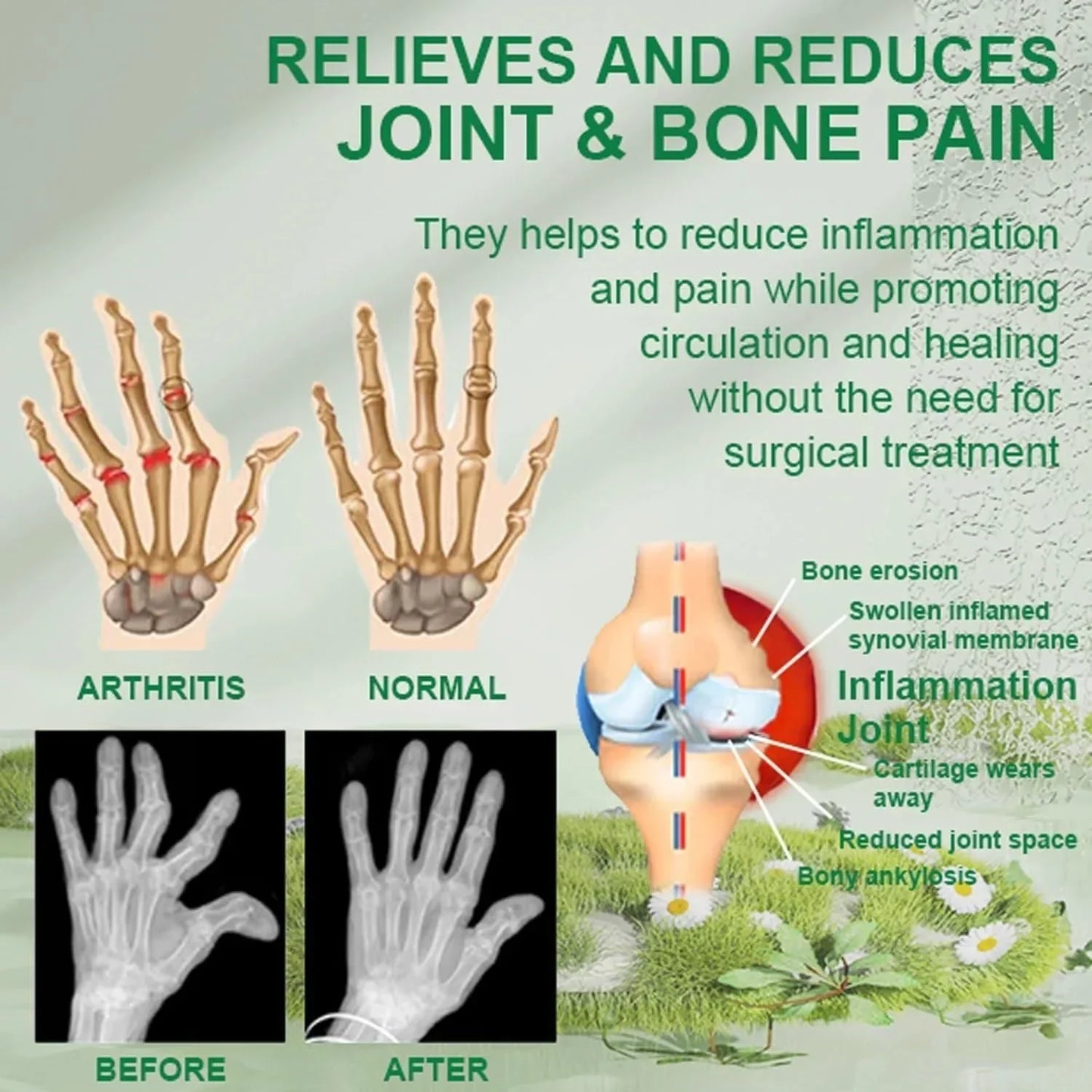 30 DAY MONEY BACK OFFER!! (Pack Of 3) BeeTherapy™ #1 Bee Venom Pain Relief Cream Buy 1 Get 1 Free!